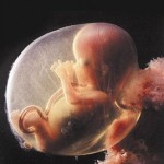 10 haftalık bebeğiniz artık minik bir erik kadar