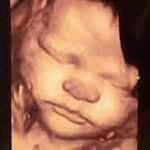 36 haftalık bebek 36 haftalık hamilelik 36 hafta gebelik 36 haftada dogan bebek yaşar mı