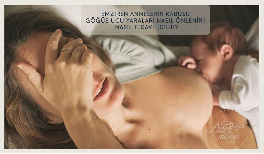 gögüs ucu yarasına ne iyi gelir göğüs ucu yarası için krem emziren annenin göğsünün yara olması emziren annelerin göğsündeki yara nasıl geçer emziren annelerin gögüs ucu yaraları nasıl geçer emzirirken gögüslerin yara olmaması için gögüs ucu yarasi