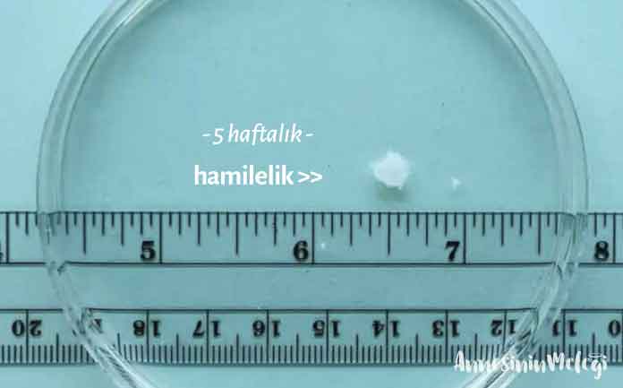 Hamileliğinizin 5. haftasında, bebeğinizin kesesi artık şekil almaya başladı. Bu haftalar bebeğin gelişiminde en kritik haftalardandır. Bebeğinizin boyu 1.5-2 mm kadardır.