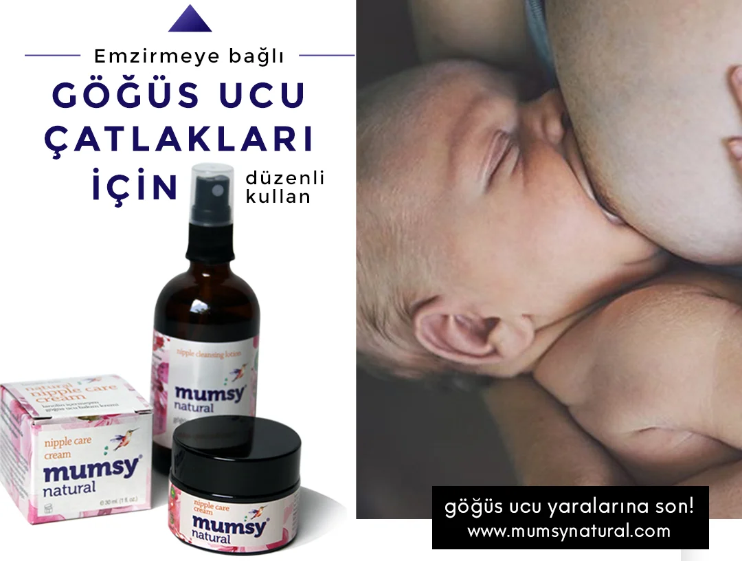 Göğüs ucu yarasına ne iyi gelir? Meme çatlaklarına ne iyi gelir