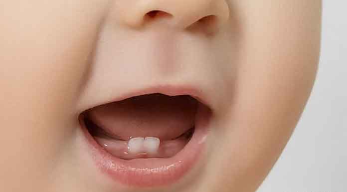 Bebeğim diş çıkarıyor ne yapmalıyım? Diş çıkaran bebeğiniz için öneriler... Bebekler ilk altı aylık dönemlerinden sonra diş çıkarmaya bağlı ateş, halsizlik, huysuzluk ve salya akıntısı gibi sıkıntılar yaşayabilir