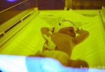 Yenidoğanda Sarılık ve Formül Mama Sorunsalı Yenidoğan sarılığında mama kullanmak şart mı?
