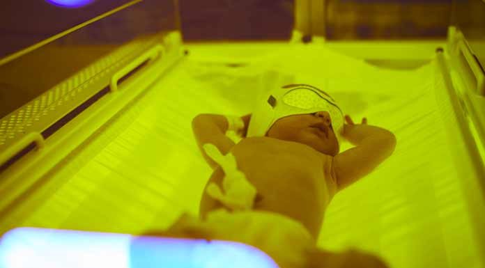 Yenidoğanda Sarılık ve Formül Mama Sorunsalı Yenidoğan sarılığında mama kullanmak şart mı?