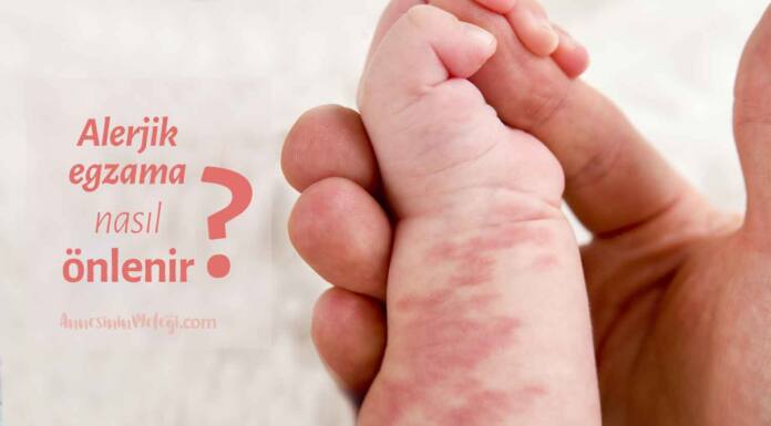 Alerjik egzama nasıl önlenir? egzama nasıl tedavi edilir