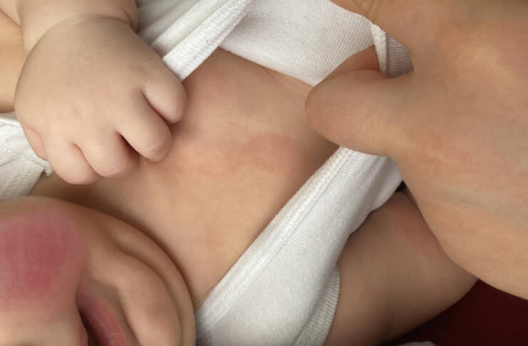 Bebeğinizin hassas cildi ilk günden itibaren kuruluk, döküntü ve kızarıklıklarla mı mücadele ediyor? Benim bebeğimin cildi de doğar doğmaz kuruydu. Marketten aldığım “hipoalerjenik” bebek şampuanı her yıkamadan sonra daha fazla tahrişe neden oldu. İçeriğinde SLS gibi aşındırıcı maddeler olduğunu öğrendiğimde çok geçti. Gerçekten nazik, katkısız ve destekleyici bir bakım için araştırırken prebiyotik içerikli, yenilebilir hammaddelerle formüle edilmiş Mumsy Natural ürünleriyle tanıştım. Hem cildi temizleyen hem de cilt florasını koruyarak bariyer gelişimine destek olan bu ürünler sayesinde ilk kez rahat bir nefes aldım. Bu yazıda, doğal bebek şampuanı ve prebiyotik içerikli losyon kullanmaya başladıktan sonra yaşadığım dönüşümü ve bu içeriklerin neden bu kadar fark yarattığını detaylıca paylaştım.